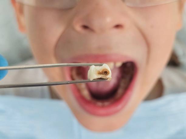 Best Pediatric Emergency Dentist in Ogdensburg, NJ